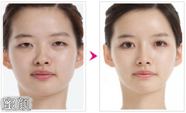 https://img.yiyiaimei.com/mnt/Editor/2020-12-23/5fe3571f96e52.jpg