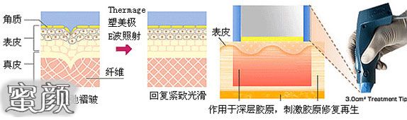 https://img.yiyiaimei.com/mnt/Editor/2020-12-26/5fe74ee9e394f.jpg