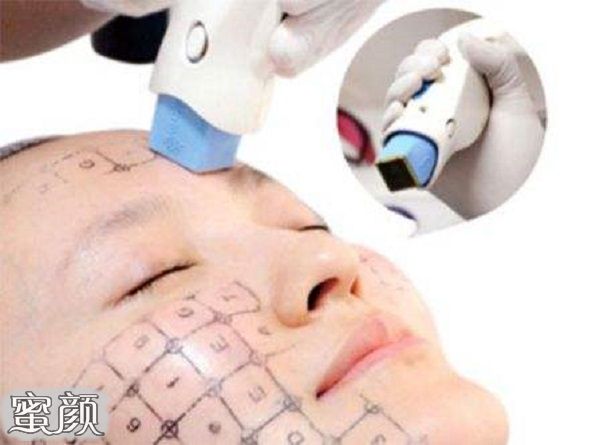 案例图片