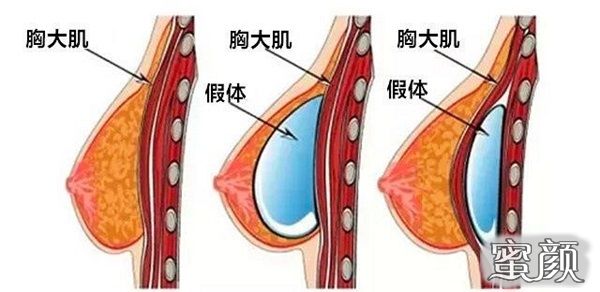 案例图片