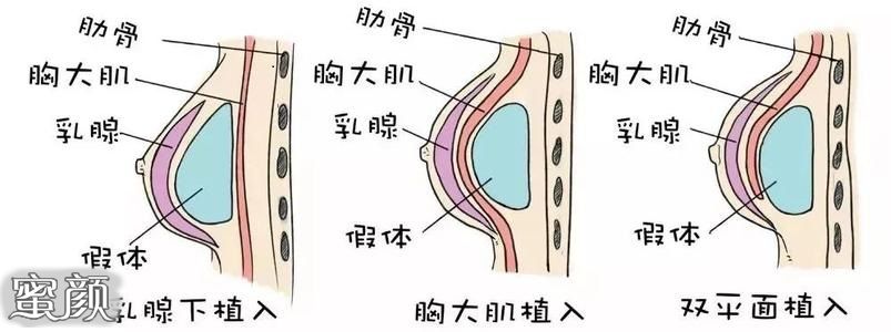 案例图片