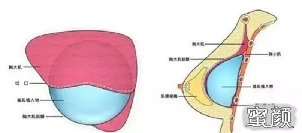 案例图片