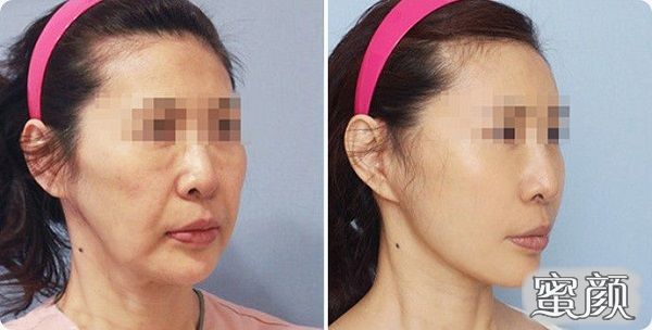 https://img.yiyiaimei.com/mnt/Editor/2020-12-27/5fe87bc665171.jpg