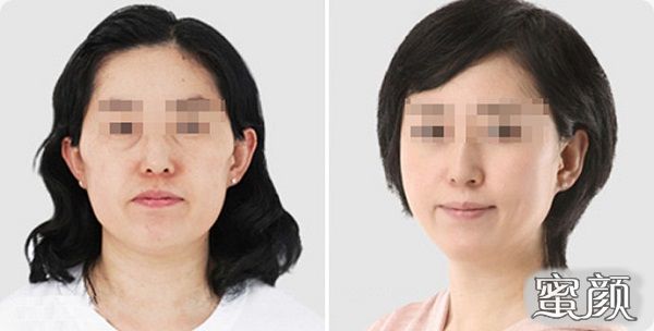 https://img.yiyiaimei.com/mnt/Editor/2020-12-27/5fe87bc6805cf.jpg