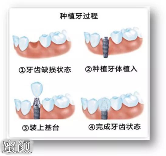 案例图片