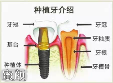 案例图片