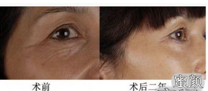 案例图片