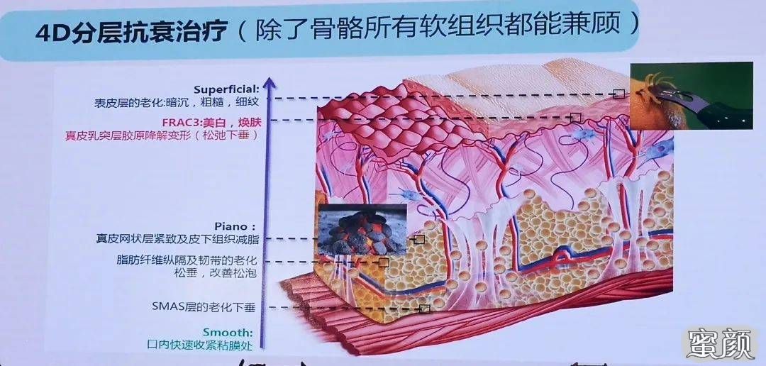 案例图片