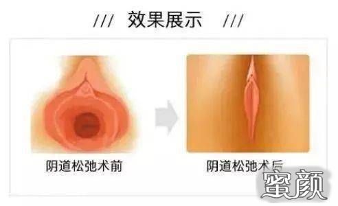 https://img.yiyiaimei.com/mnt/Editor/2021-01-01/5fef22a626143.jpg