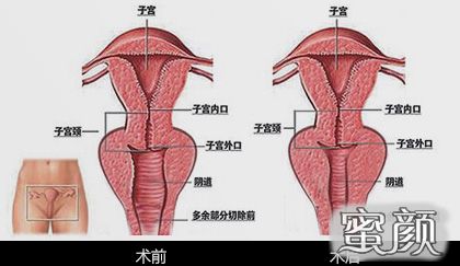 案例图片