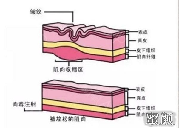 案例图片