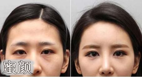 案例图片