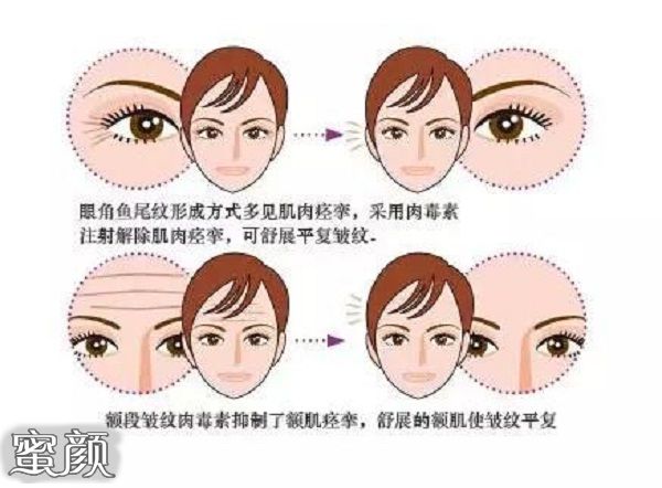 案例图片
