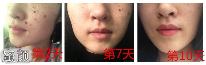 案例图片