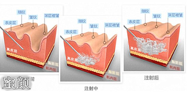 案例图片