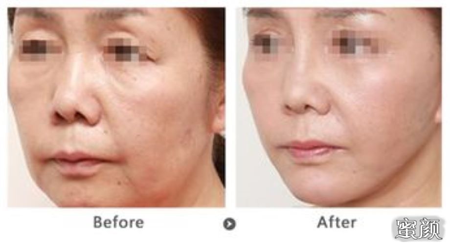 https://img.yiyiaimei.com/mnt/Editor/2021-01-04/5ff2da66e94c1.jpg