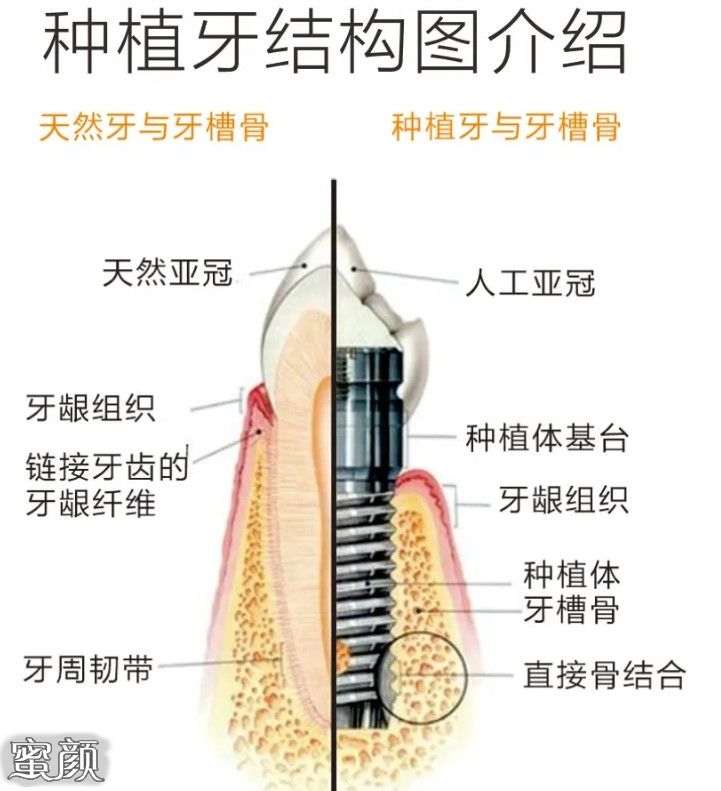 案例图片