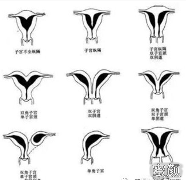 https://img.yiyiaimei.com/mnt/Editor/2021-01-05/5ff437fe4eb8c.jpg