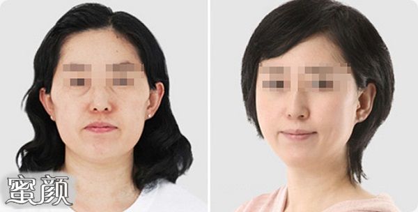 https://img.yiyiaimei.com/mnt/Editor/2021-01-05/5ff4795b375bb.jpg