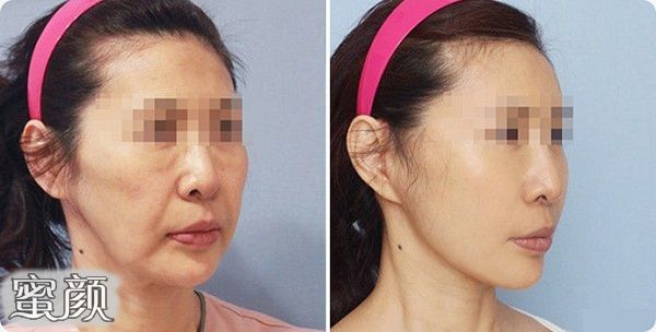 https://img.yiyiaimei.com/mnt/Editor/2021-01-05/5ff4795b5f218.jpg