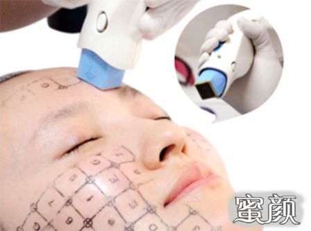 https://img.yiyiaimei.com/mnt/Editor/2021-01-05/5ff4797ee6cf9.jpg