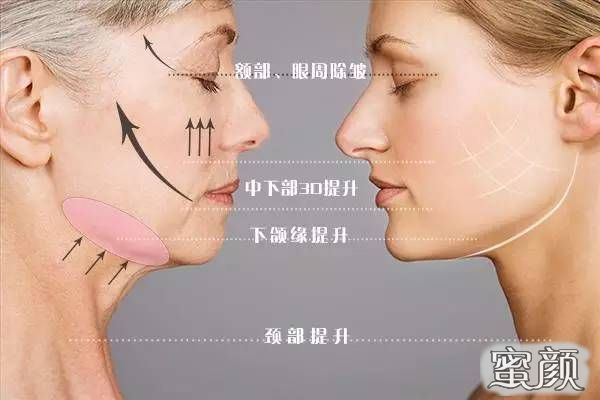 https://img.yiyiaimei.com/mnt/Editor/2021-01-06/5ff543c47073f.jpg