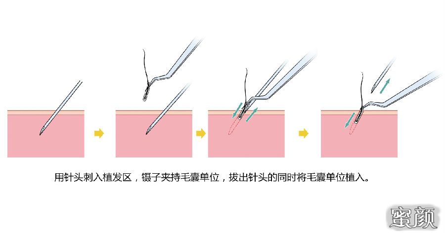 案例图片