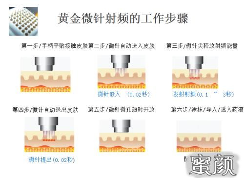 案例图片