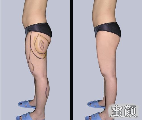 https://img.yiyiaimei.com/mnt/Editor/2021-01-07/5ff64d129654f.jpg