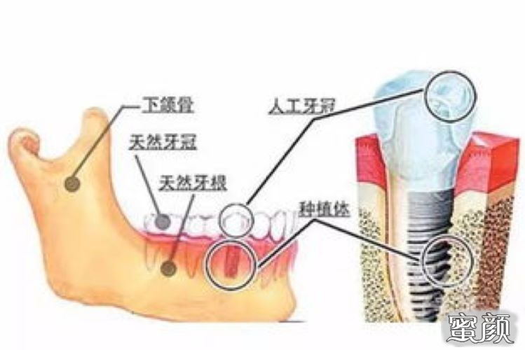 案例图片