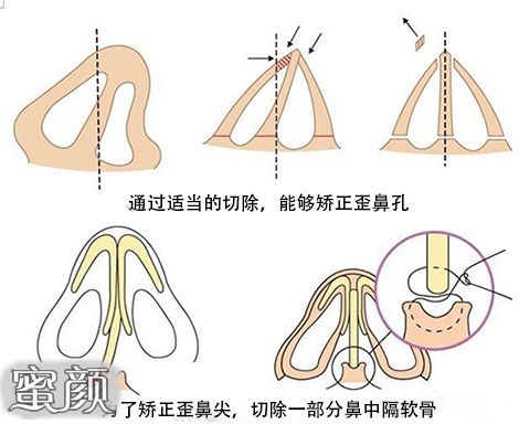 案例图片