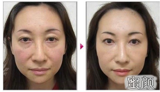 https://img.yiyiaimei.com/mnt/Editor/2021-01-08/5ff828ee11d5f.jpg