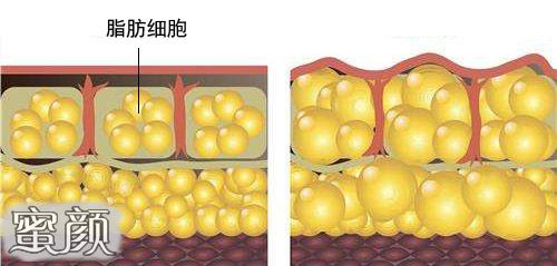 https://img.yiyiaimei.com/mnt/Editor/2021-01-09/5ff946c37be8c.jpg