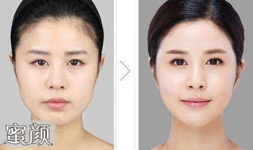 https://img.yiyiaimei.com/mnt/Editor/2021-01-09/5ff9471b240d5.jpg