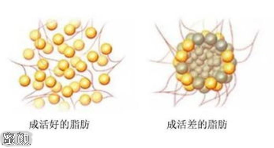 案例图片