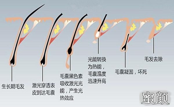 案例图片