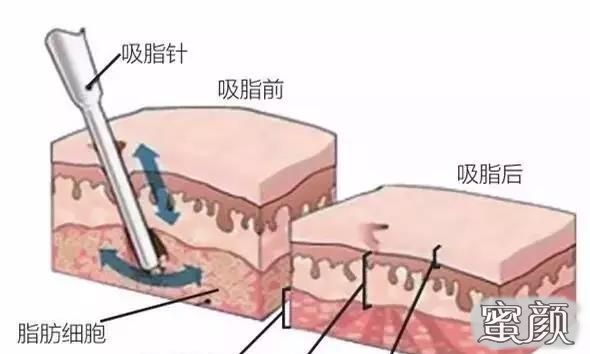 案例图片