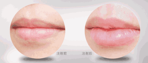 https://img.yiyiaimei.com/mnt/Editor/2021-01-12/5ffd6457d1db4.jpg