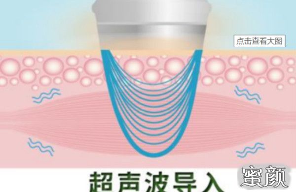 https://img.yiyiaimei.com/mnt/Editor/2021-01-12/5ffd7d24d4cf2.jpg