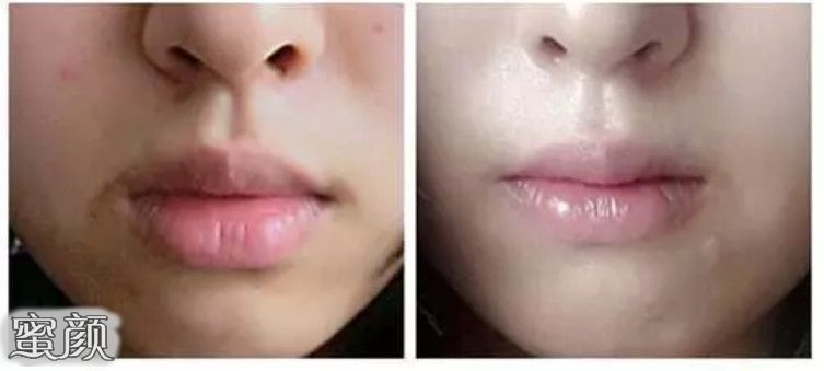 https://img.yiyiaimei.com/mnt/Editor/2021-01-12/5ffdae1f12355.jpg