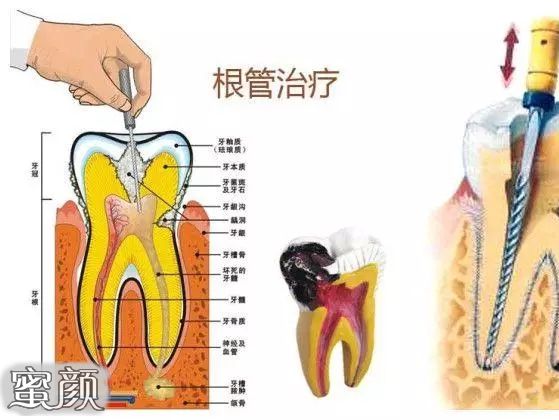 案例图片