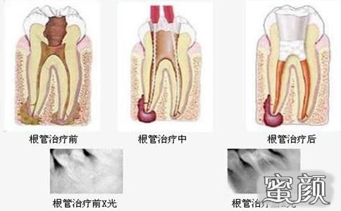 案例图片