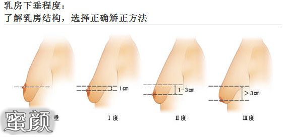 案例图片