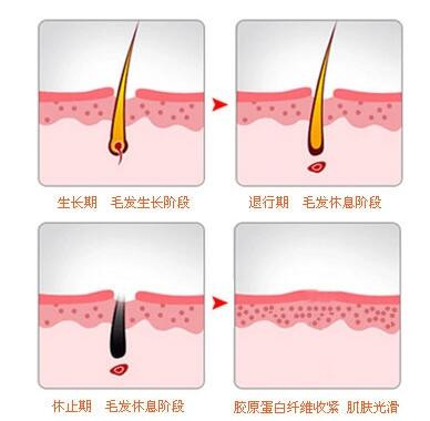 案例图片