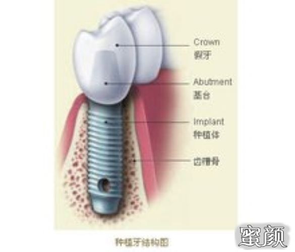 案例图片