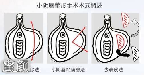 案例图片