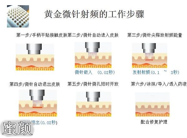 案例图片