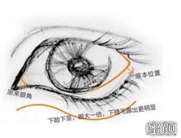 案例图片