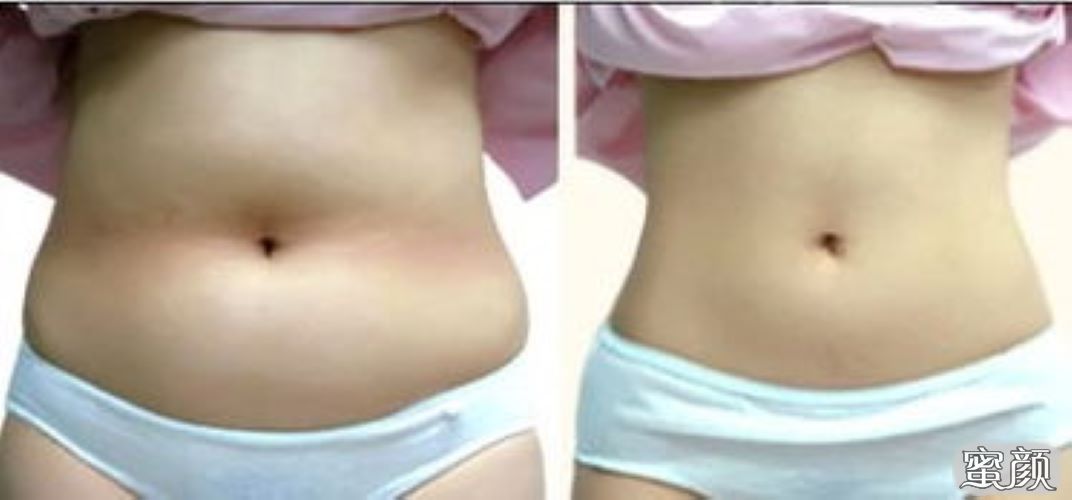 https://img.yiyiaimei.com/mnt/Editor/2021-01-19/6006a52845244.jpg