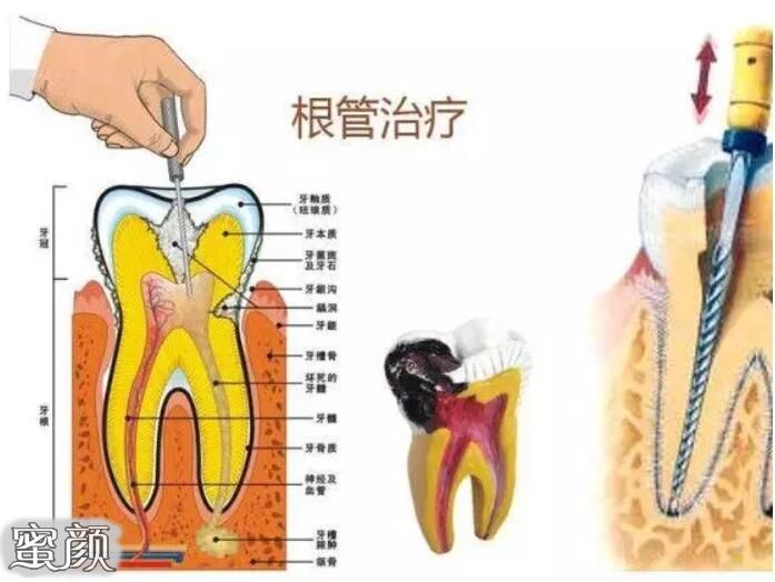 案例图片